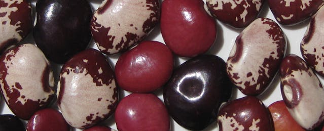 Embracing Variability with Universal Design for Learning